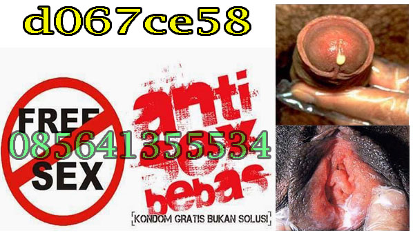 Foto Cara Mengobati Sipilis Atau Raja Singa