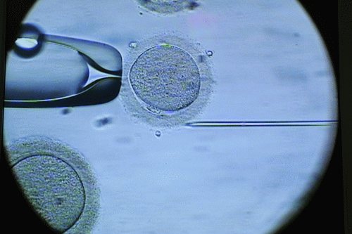 Salah satu blastomer sedang di ambil pada saat teknik PGD dilakukan (IVF) Salah satu blastomer sedang di ambil pada saat teknik PGD dilakukan (IVF)