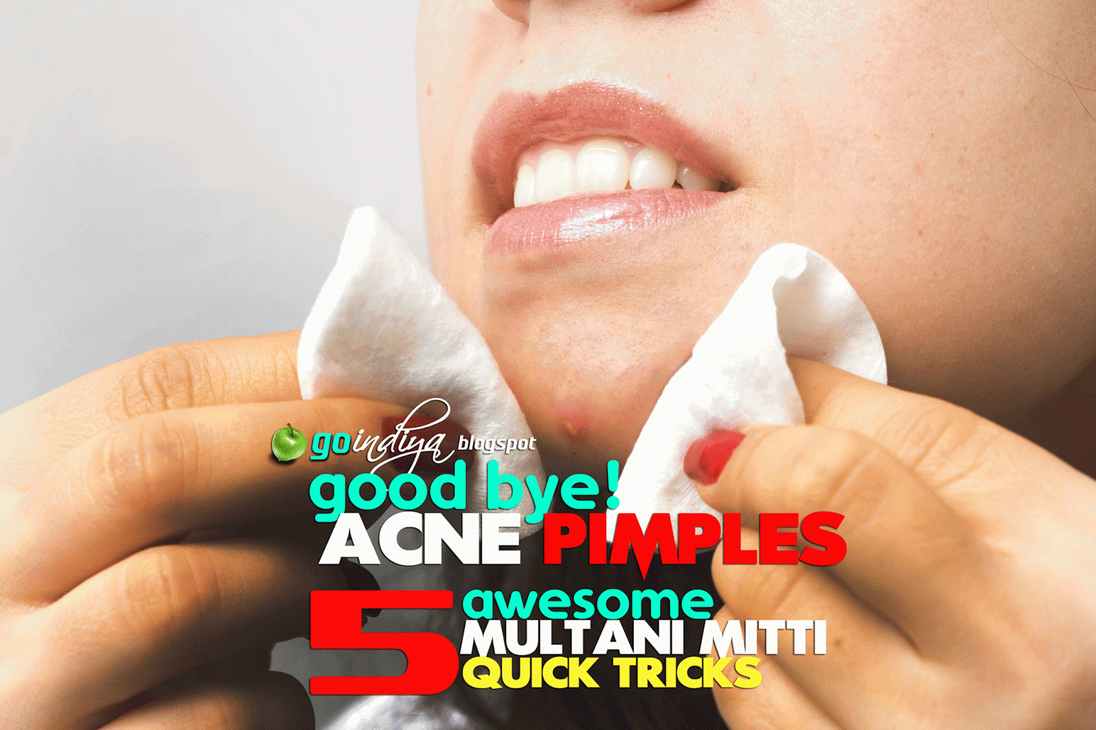 Home Remedies For Keeping Acne Away Home Remedies For Keeping Acne Away