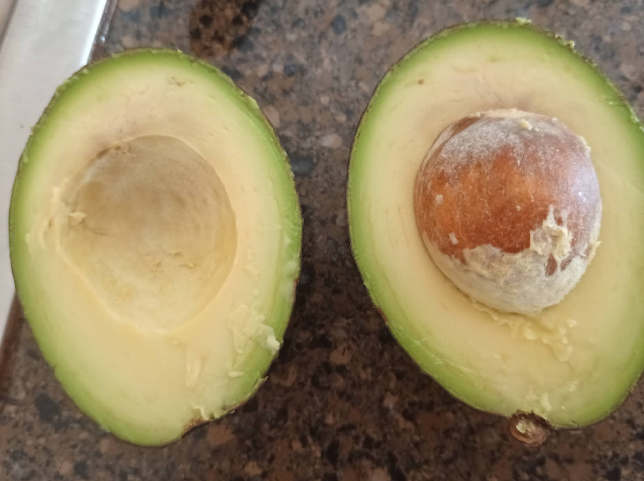 You Need To See This: The Avocado Thottie Scandal - iufst3q