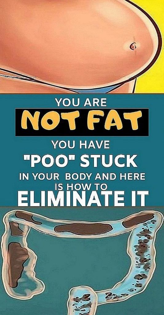 You Are Not Fat!! You Have “Poo” Stuck In Your Body & Here Is How To