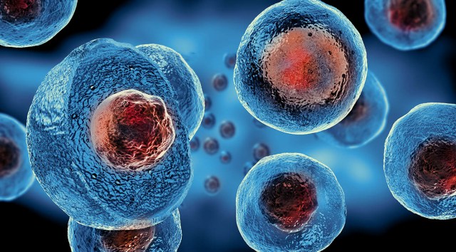 Stem Cell, Gene Therapies Cause New Headaches for Insurers