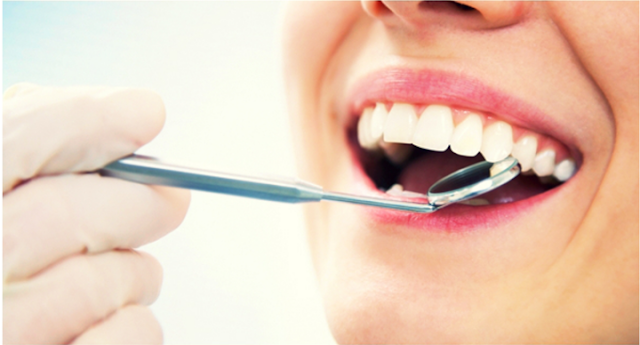 Perawatan Gigi Dengan Mudah Dan Tepat