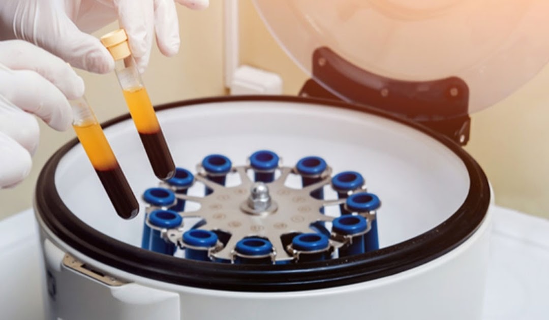 Apa itu Mean platelet volume (MPV)? - DWI PURWANTO
