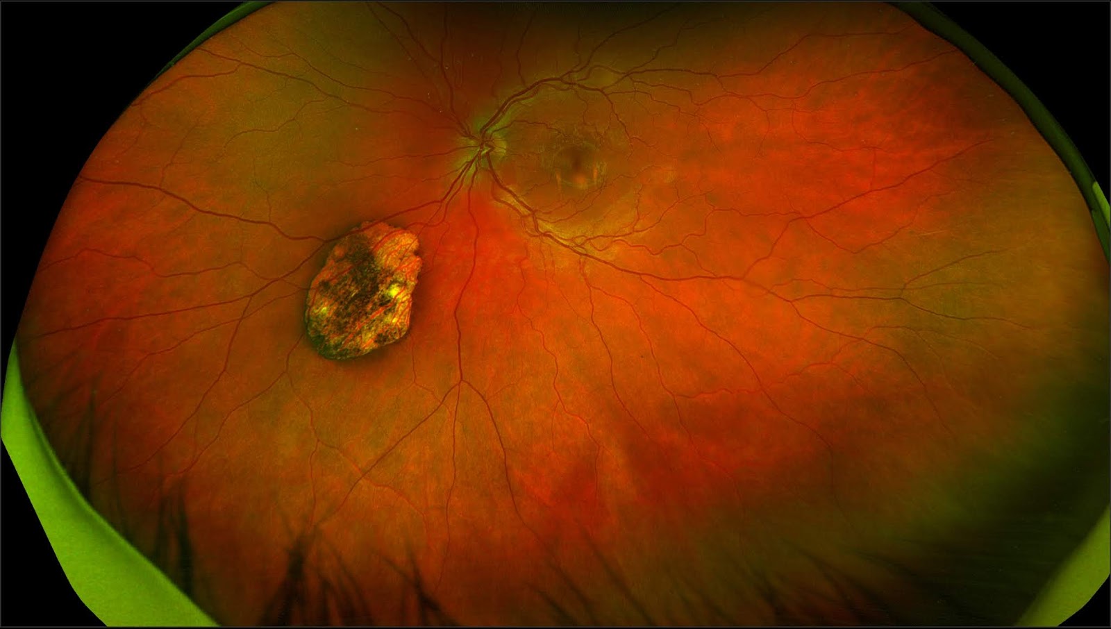 Sonoran Desert Eye Center 2019