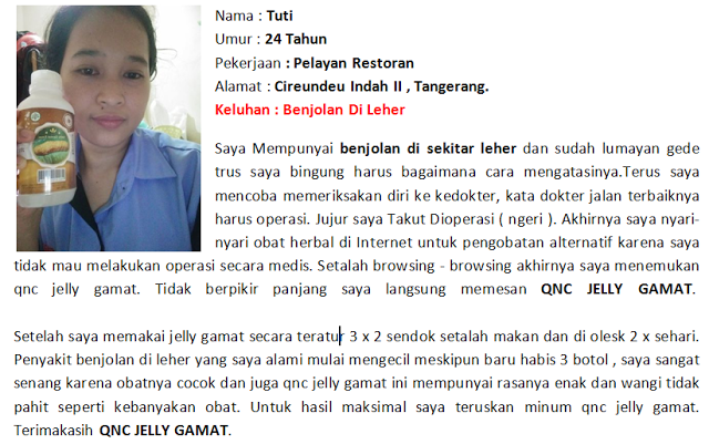 Pengobatan Alternatif Benjolan Di Leher Sebelah Kanan Tanpa Harus Operasi Pengobatan Alternatif Benjolan Di Leher Sebelah Kanan Tanpa Harus Operasi
