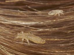 Cara Menghilangkan Kutu Rambut dengan Cepat | Roliyan.com Cara Menghilangkan Kutu Rambut dengan Cepat | Roliyan.com