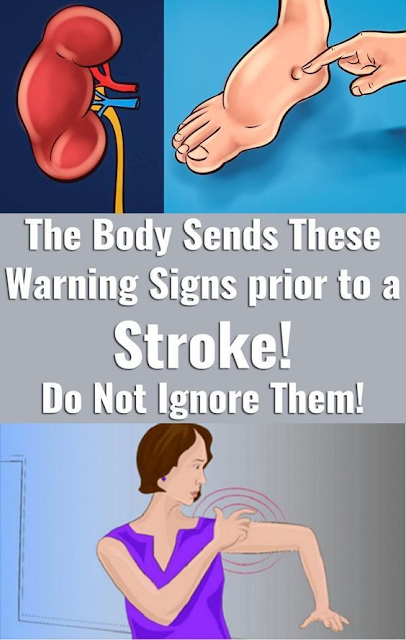 One Month Before a Heart Attack, Your Body Will Warn You – Here are the ...