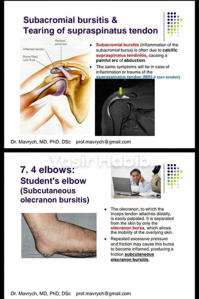 Clinicals and Fractures of Upper Limb Anatomy - MBBS WORLD