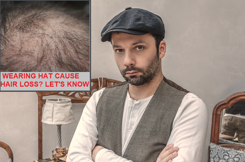 क्या लगातार टोपी (Baseball Cap) पहनने से बाल झड़ने लगते हैं? Does