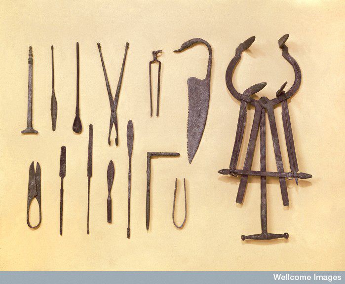 amudu HAVE YOU SEEN THE THE CARVING OF THE ROMAN SURGICAL TOOLS YET?