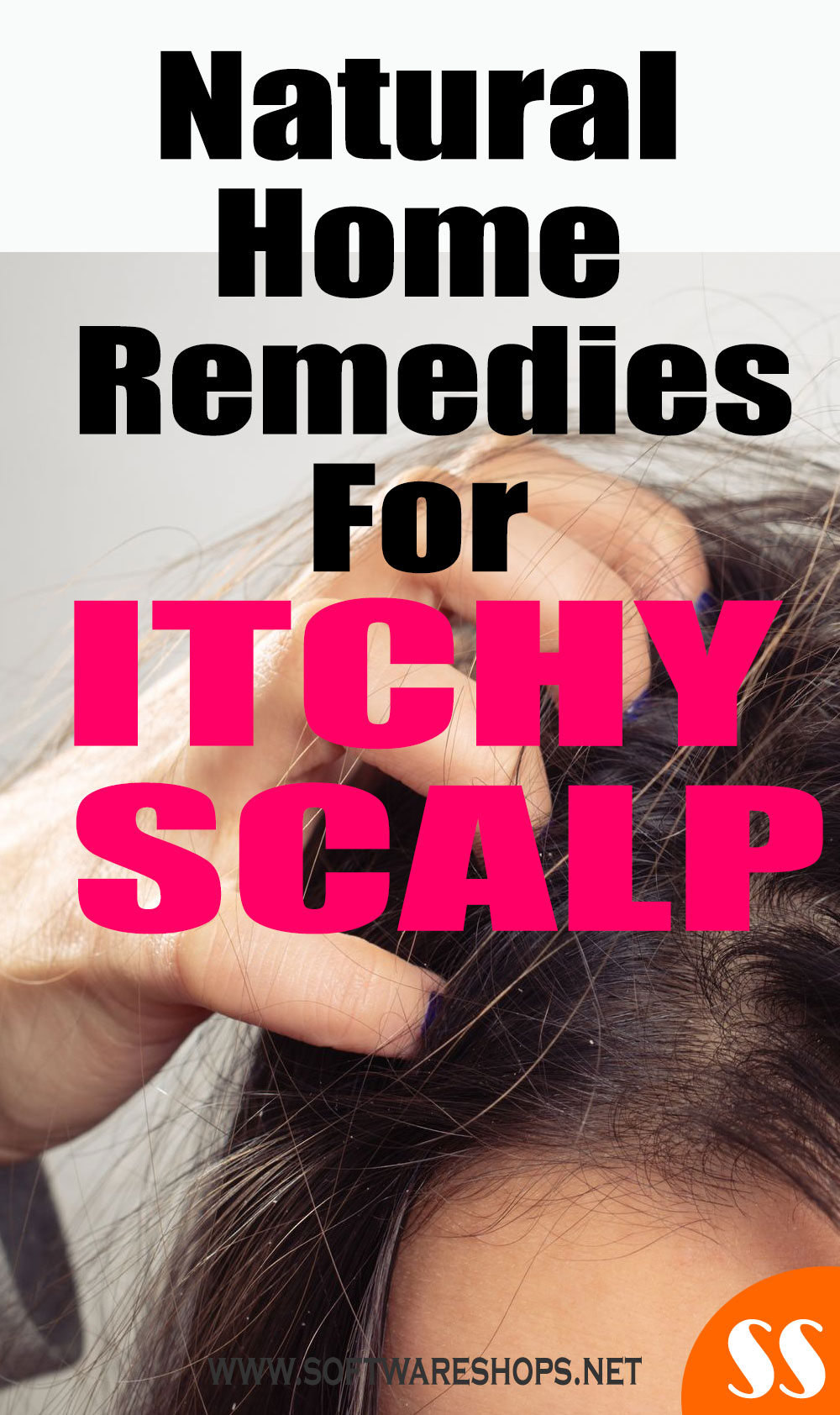 Natural Home Remedies For Itchy Scalp