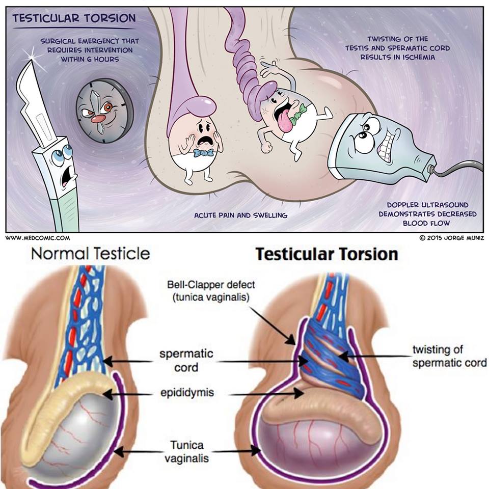 Hidup Matiku Kalau Anak Lelaki Mengadu Sakit Bahagian Telur