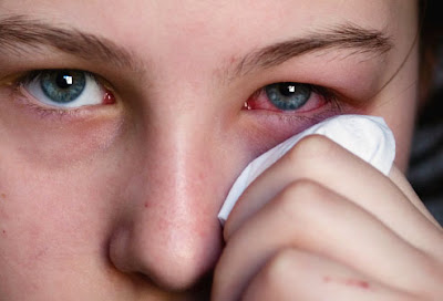 como eliminar la conjuntivitis