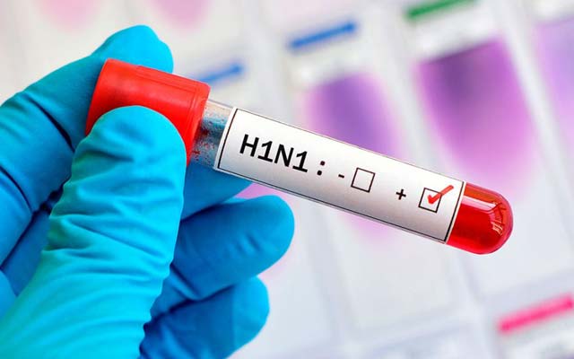 Jacobina confirma caso de H1N1; três suspeitas de Covid-19 aguardam resultados