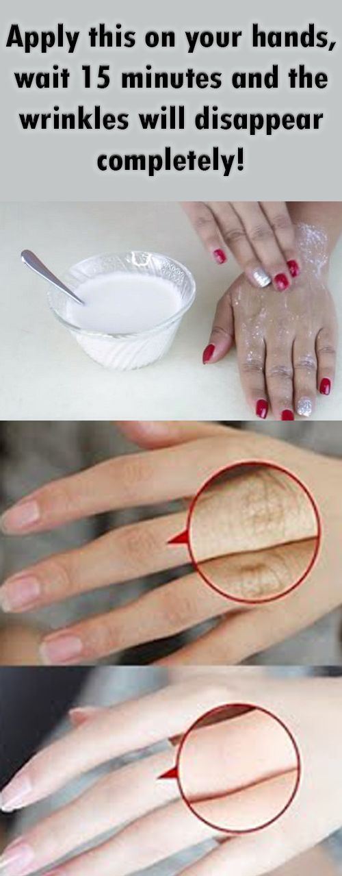 Apply This On Your Hands, Wait 15 Minutes And Wrinkles Disappear
