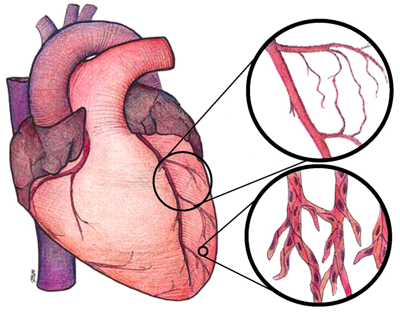 Отеки при сердечных заболеваниях
