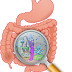 Gastrointestinal : Disorders,Symptoms,Causes,Remedies.