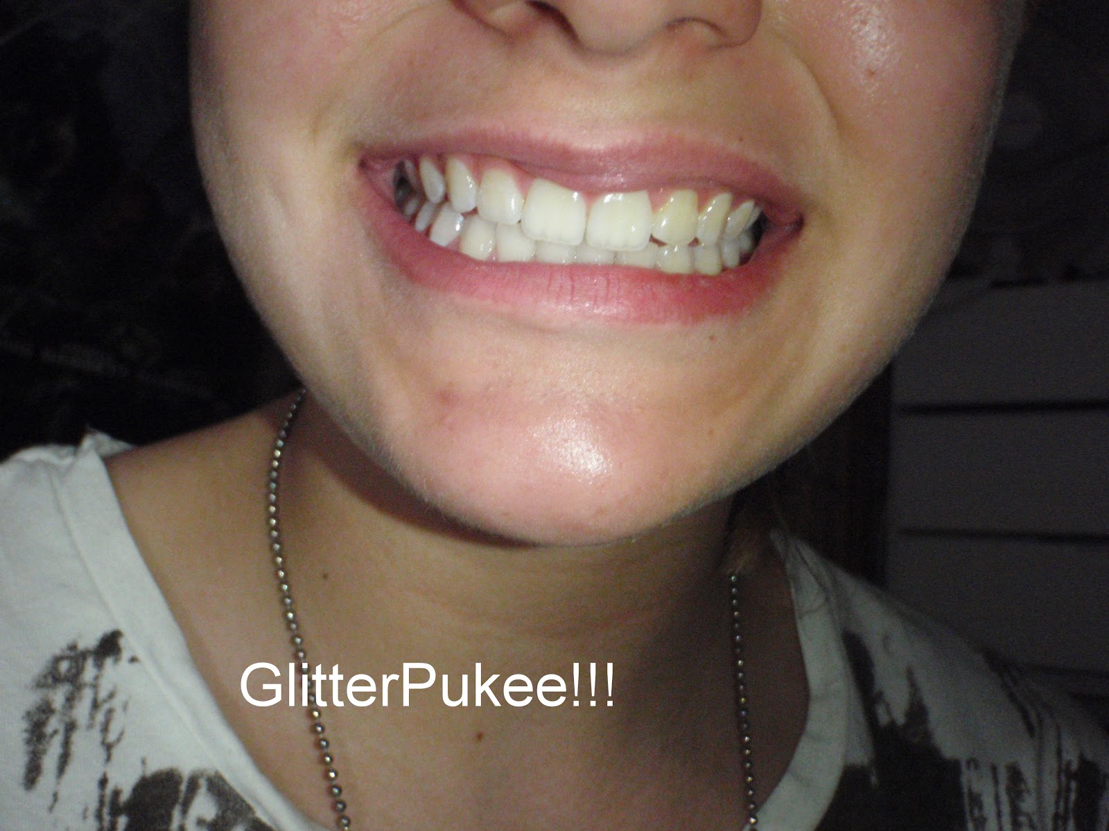 GLITTER PUKE!!: Whitening Lightning Teeth Whitening kit