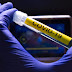 República Dominicana tendrás acceso a primera vacuna contra el coronavirus revela la OPS