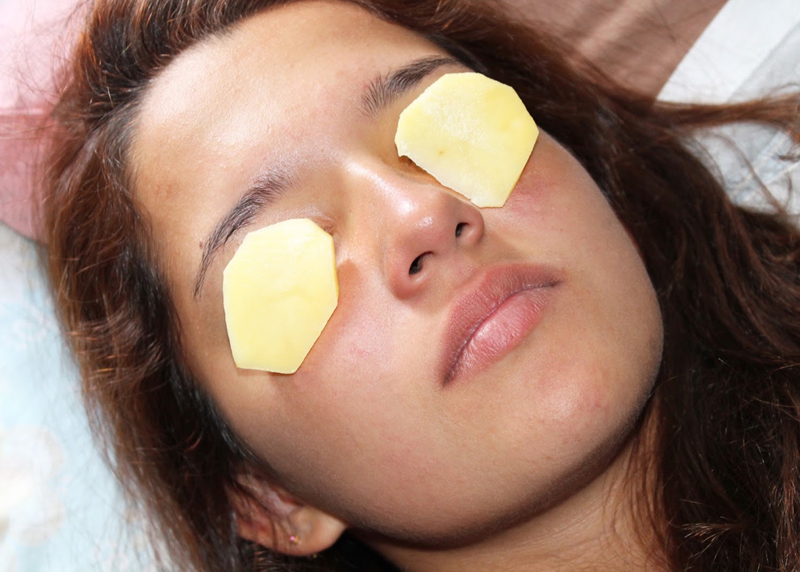 Depend On Raw Potato 5 Ways to Get Rid of Dark Circles Naturally