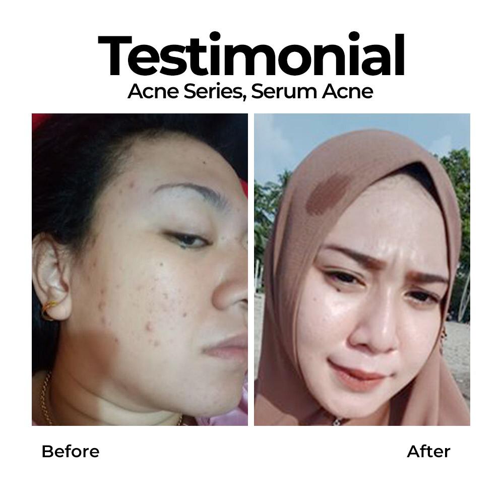 Testimoni Para Pengguna Produk Ms Glow