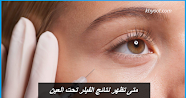 متى تظهر نتائج الفيلر تحت العين