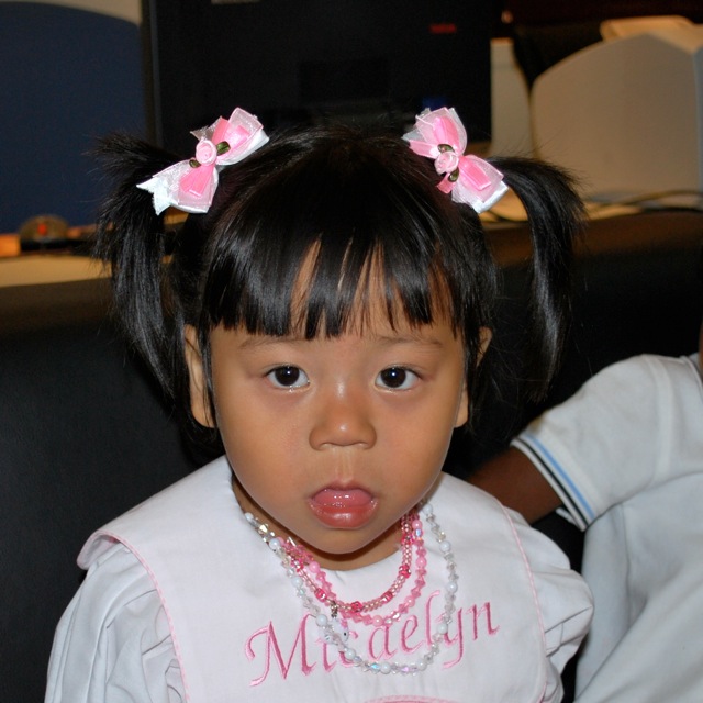 Bring my sons from afar... Before and After Tongue Reduction Surgery