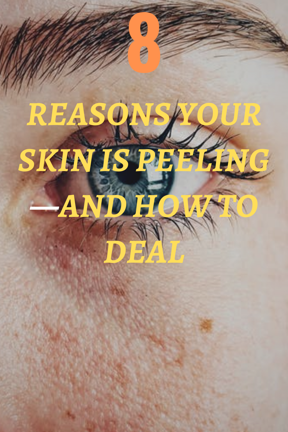 8 Reasons Your Skin Is Peeling—And How to Deal