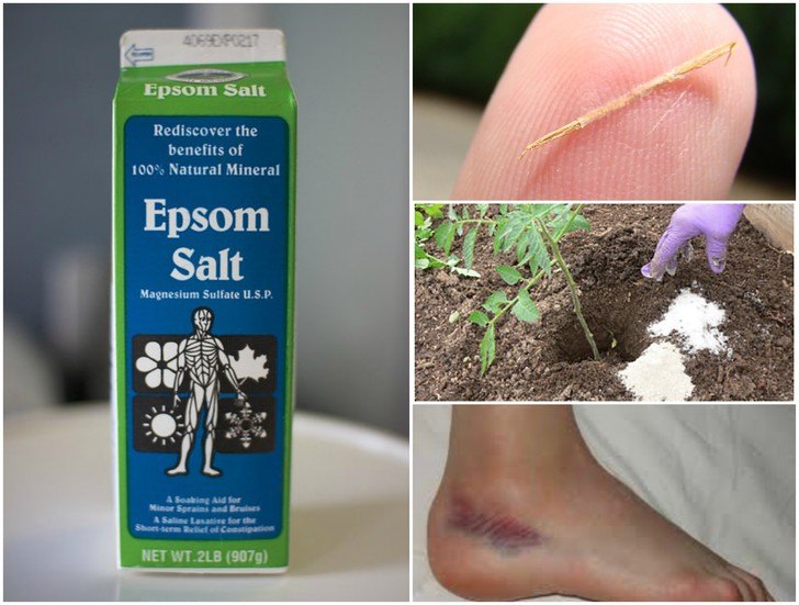 Health Remedies 9 Ways How You Can Use Epsom Salt For Internal And