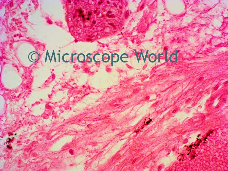Microscope World Blog Optic Nerve Under the Microscope