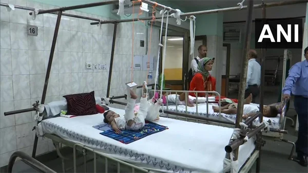 To Treat 11-Month-Old's Fracture, Doctors First Had To Plaster Her Doll, New Delhi, News, Humor, Injured, hospital, Treatment, Video, National