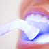 Cách chăm sóc răng sau tẩy trắng 