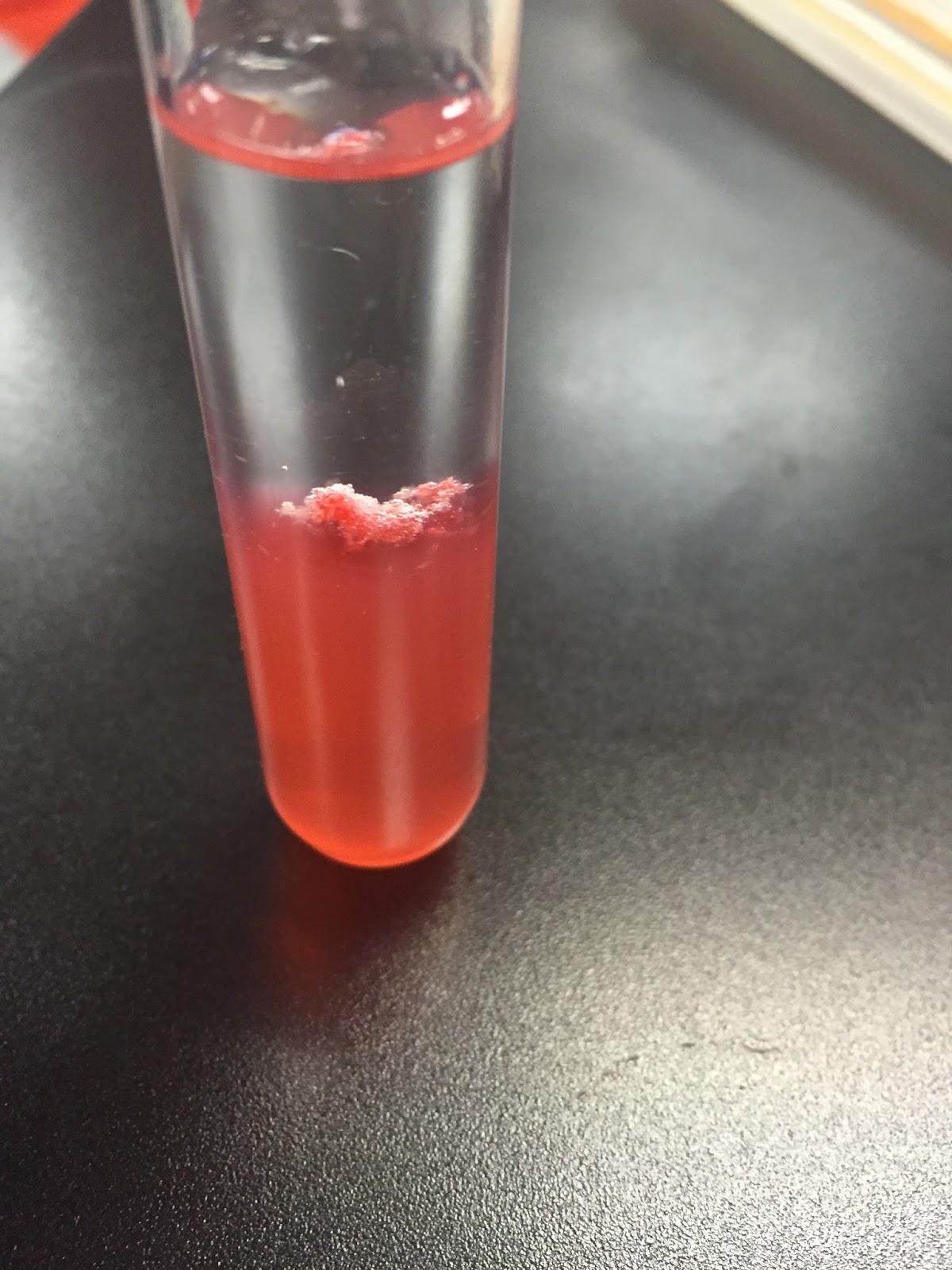 Ananya's Biology Blog: Human DNA Extraction Lab
