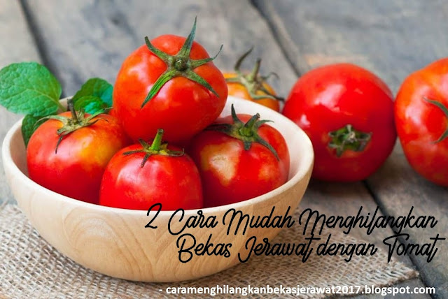 2 Cara Mudah Menghilangkan Bekas Jerawat dengan Tomat