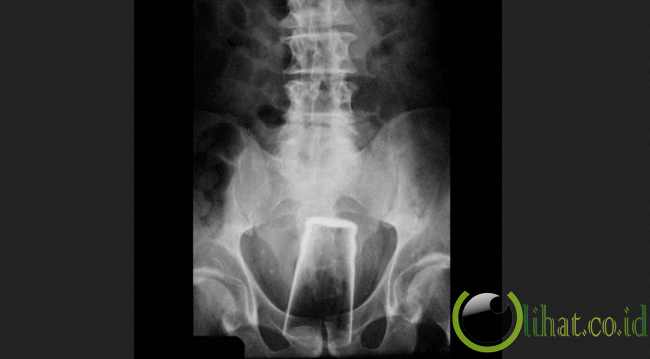 Анальная пробка Doc Johnson Mood Naughty 4.5