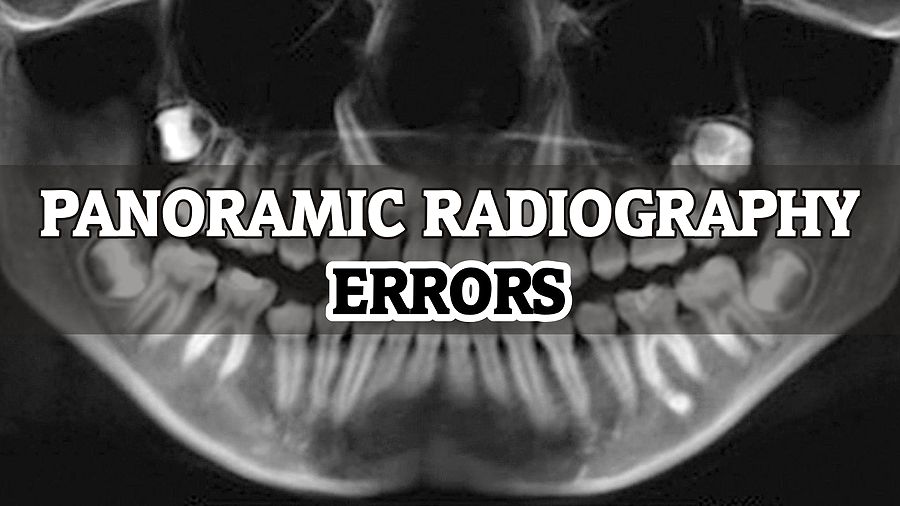 PANORAMIC RADIOGRAPHY Errors you should not make