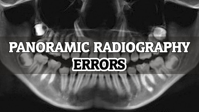 PANORAMIC RADIOGRAPHY: Errors you should not make