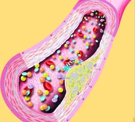 HDL Levels Are Too Low HDL Levels Are Too Low