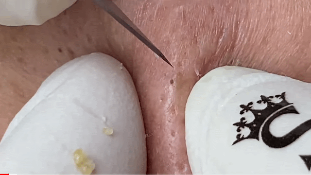 91f7bef9188d3d18d34845fc41ca6a8c04689cc5