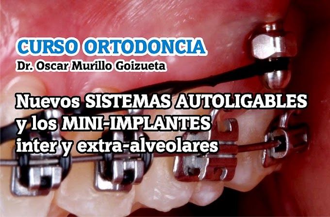 CURSO ORTODONCIA: Los Nuevos Sistemas Autoligables y los Mini-implantes inter y extra-alveolares - Dr. Oscar Murillo Goizueta