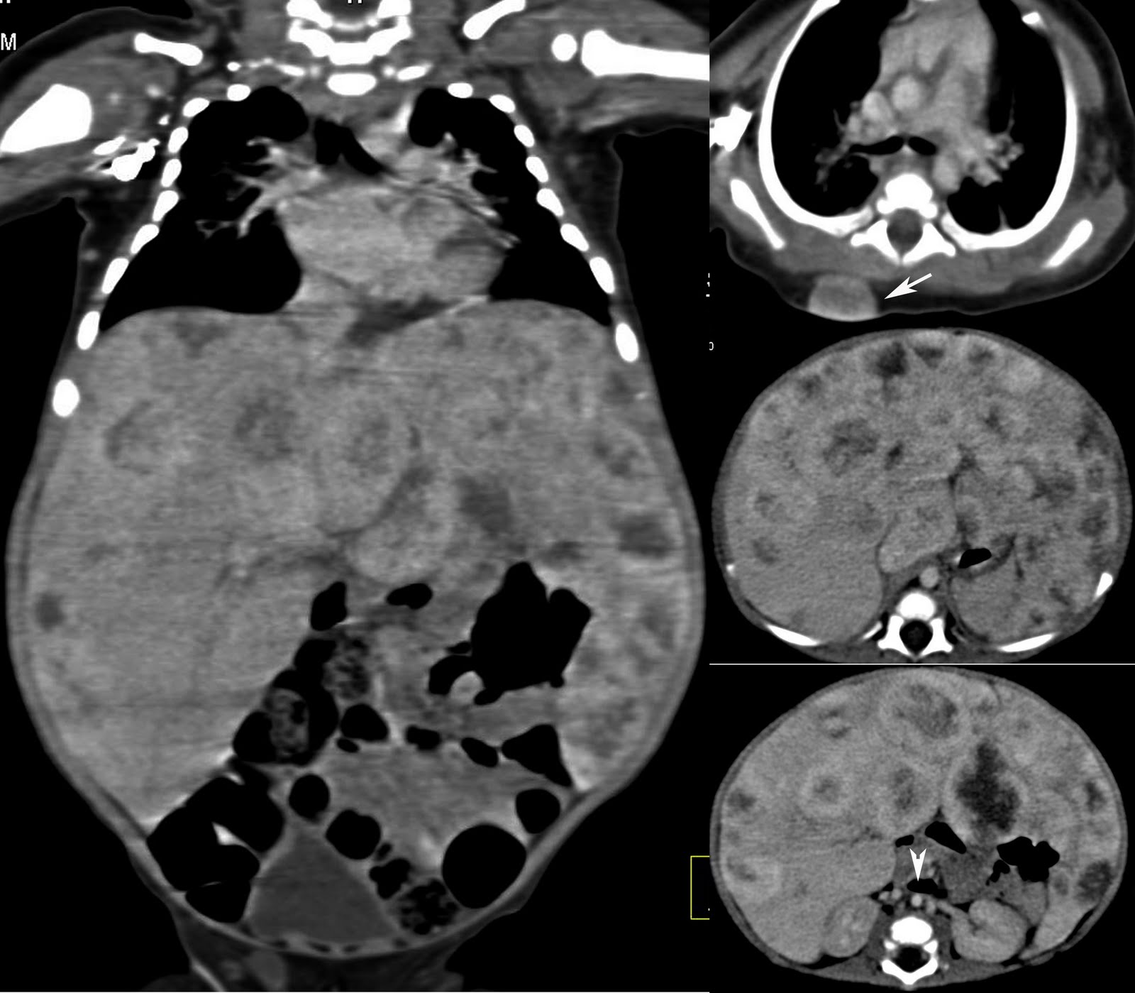 Radiodiagnosis - Imaging is Amazing-Interesting cases: July 2011