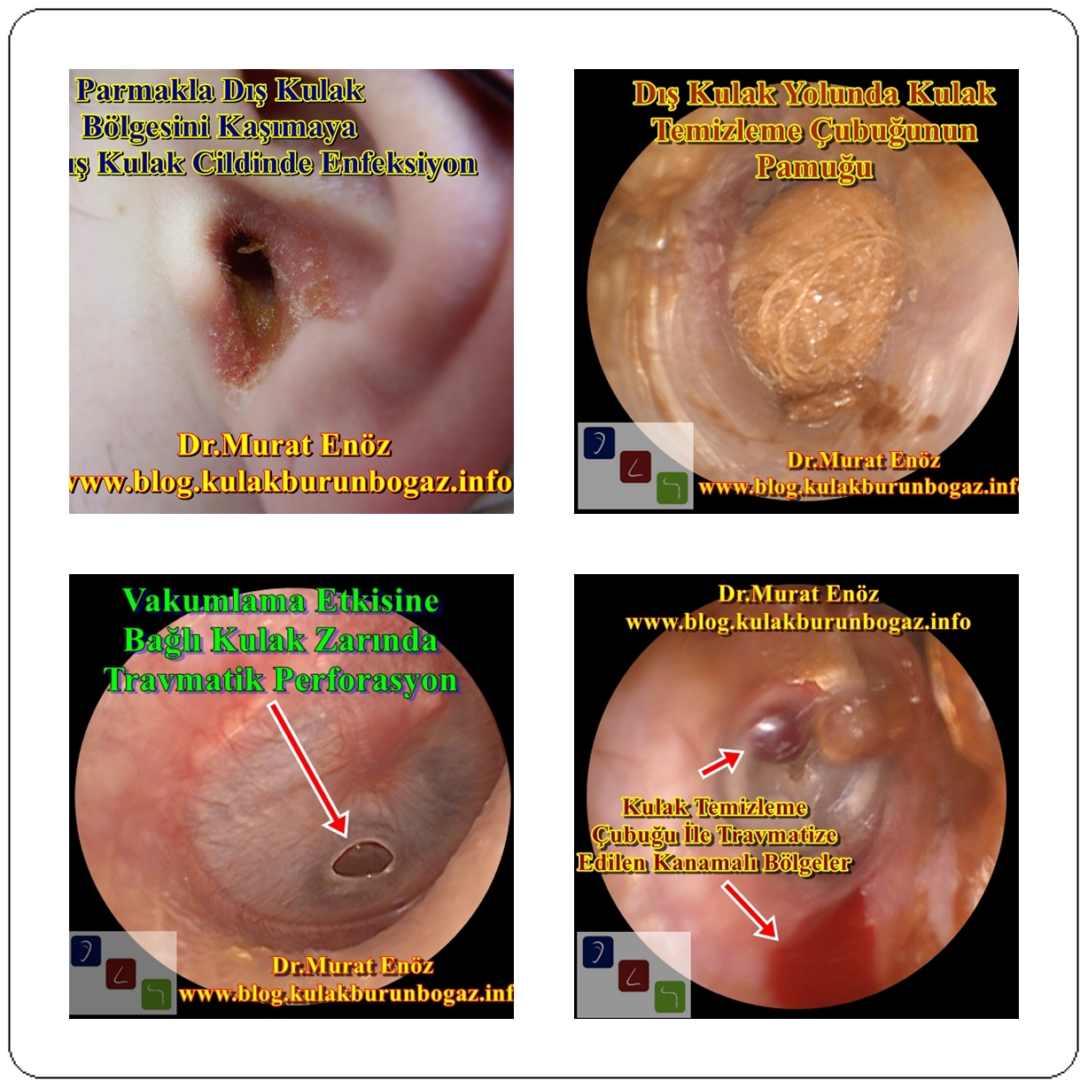 Some The Traumatic Ear Problems Which You to Yourself!