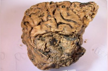 Brain tissue