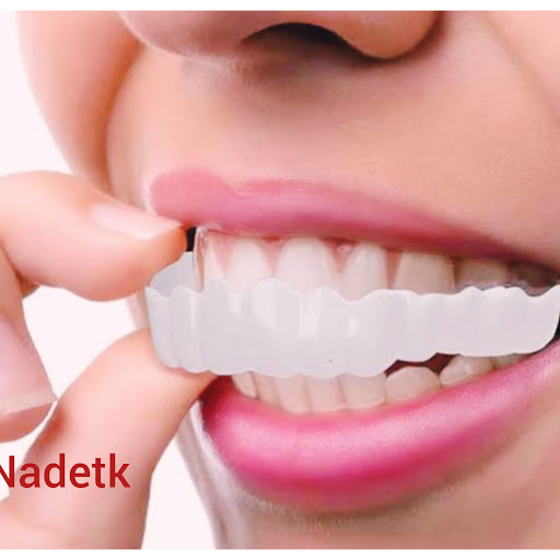 أسعار ابتسامة هوليود المتحركة التي تم أخذها على الابتسامة وكيفية الحصول على ابتسامة هوليود المتحركة ابتسامة هوليود المتحركة