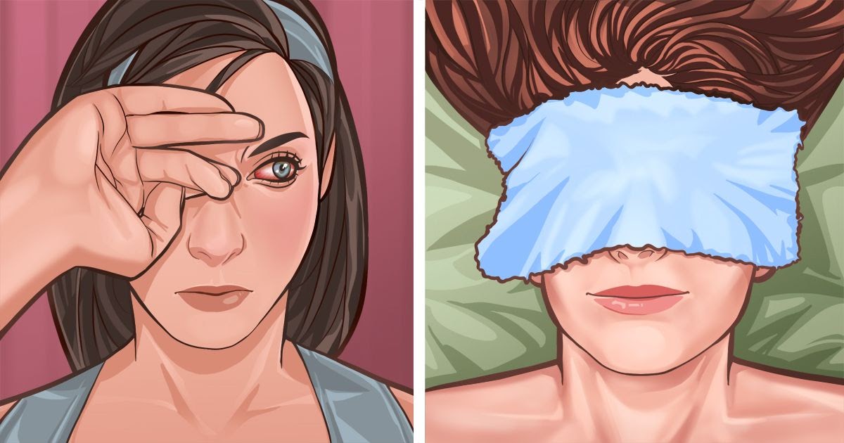 5-home-remedies-for-itchy-eyes