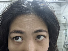 wrinkles and dark circles