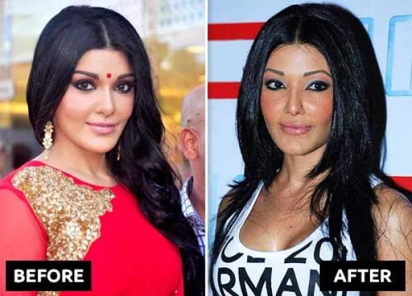 कोएना मित्रा plastic surgery now and then