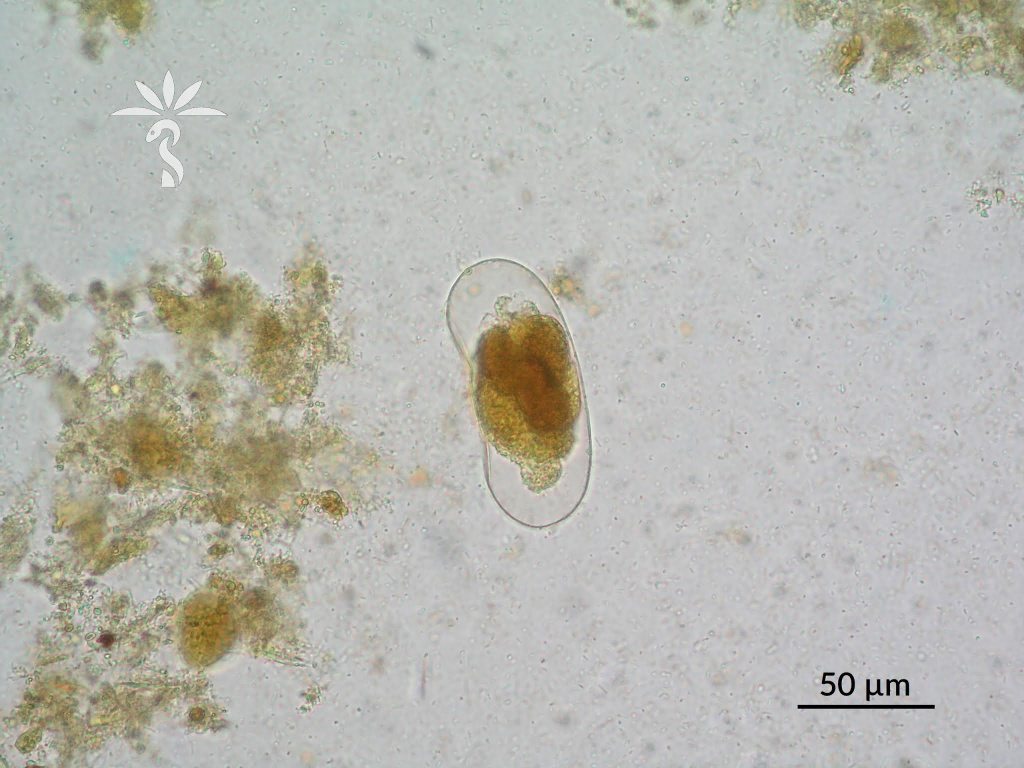 Rhabditiform Larvae: Understanding The Parasite Threat To Dogs - q2rkpt2