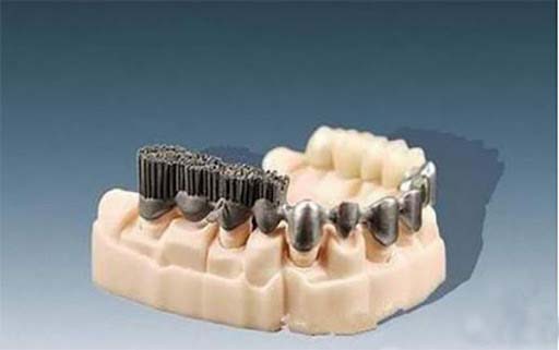 DMLS Dental Crown and Bridge Jamnagar